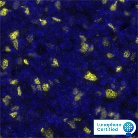 FOXP3 Antibody was detected in immersion fixed paraffin-embedded sections of mouse Thymus using Rabbit Anti-Mouse FOXP3 Monoclonal Antibody (Catalog # MAB8214) at 20ug/mL at 37 ° Celsius for 4 minutes. Before incubation with the primary antibody, tissue underwent an all-in-one dewaxing and antigen retrieval preprocessing using PreTreatment Module (PT Module) and Dewax and HIER Buffer H (pH 9; Epredia Catalog # TA-999-DHBH). Tissue was stained using the Alexa Fluor™ Plus 647 Goat anti-Rabbit IgG Secondary Antibody at 1:200 at 37 ° Celsius for 2 minutes. (Yellow; Lunaphore Catalog # DR647RB) and counterstained with DAPI (blue; Lunaphore Catalog # DR100). Specific staining was localized to the nucleus. Protocol available in COMET™ Panel Builder.