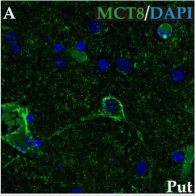 Expression of MCT8 and OATP1C1 in D1-MSN (direct pathway medium-sized spiny neurons) in human and macaque striatum. Representative confocal microscope compositions from double-stained sections for MCT8 (green) or OATP1C1 (green) and for the D1-MSN marker DRD1 (red) in caudate nucleus or putamen. Merged images (right side) show the colocalization of both signals. Coexpression of MCT8 and DRD1 is observed in human (A–C) and macaque (D–F) striatum. Coexpression of OATP1C1 and DRD1 is observed in human (G–I) and macaque (J–L) striatum. Counterstaining with DAPI (blue) shows nuclei of all cells. Note that in humans the MCT8 signal is located mainly at the cell membrane, while in macaques it is located at the membrane and in the cytoplasm. Cd: caudate nucleus; DRD1: Dopamine receptor type 1; D1-MSN: D1 receptor-expressing medium-sized spiny neurons; Put: putamen. Scale bar = 50 μm. Image collected and cropped by CiteAb from the following open publication (//pubmed.ncbi.nlm.nih.gov/37298594), licensed under a CC-BY license. Not internally tested by R&D Systems.