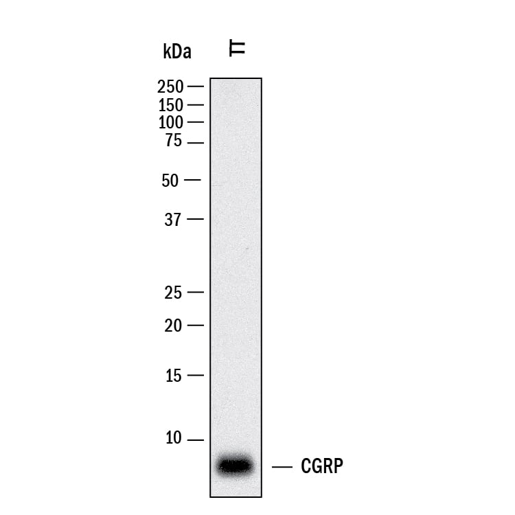 Western blot shows lysates of TT human medullary thyroid cancer cell line. PVDF membrane was probed with 0.5 µg/mL of Rabbit Anti-Human CGRP Monoclonal Antibody (Catalog # MAB83503) followed by HRP-conjugated Anti-Rabbit IgG Secondary Antibody (Catalog # HAF008). A specific band was detected for CGRP at approximately 8 kDa (as indicated). This experiment was conducted under reducing conditions and using Western Blot Buffer Group 1.