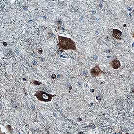 Neurogranin was detected in immersion fixed paraffin-embedded sections of human brain (medulla) using Mouse Anti-Human Neurogranin Monoclonal Antibody (Catalog # MAB79471) at 15 &micro;g/mL for 1 hour at room temperature followed by incubation with the Anti-Mouse IgG VisUCyte&trade; HRP Polymer Antibody (VC001). Before incubation with the primary antibody, tissue was subjected to heat-induced epitope retrieval using Antigen Retrieval Reagent-Basic (CTS013). Tissue was stained using DAB (brown) and counterstained with hematoxylin (blue). Specific staining was localized to neuronal cell bodies. Staining was performed using our protocol for IHC Staining with VisUCyte HRP Polymer Detection Reagents.