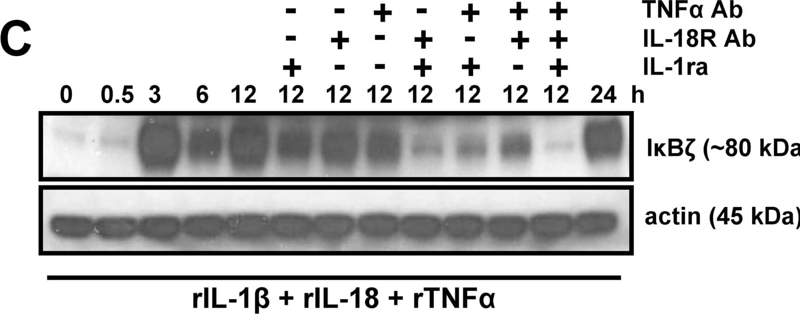 The synergistic effect of TNF alpha  and IL-1 beta /IL-18 on I kappa B zeta  protein expression is partially suppressed with a TNF alpha -specific Ab, but completely blocked with IL-1 beta  and/or IL-18 neutralization.KG-1 cells (106/ml) were stimulated with rIL-1 beta , rIL-18, rTNF alpha  (10 ng/ml each) (A), or the indicated combinations of these cytokines (B and C) for the indicated time points. At selected time points, the cells were incubated with the recombinant proteins in the presence of IL-1ra (100 µg/ml), IL-18R Ab (10 µg/ml), TNF alpha  Ab (10 µg/ml), or different combinations of these neutralizing agents. Protein-matched total cell extracts were analyzed by Western blotting using anti-serum against I kappa B zeta  and actin Ab. Results are representative of at least 3 separate experiments. Image collected and cropped by CiteAb from the following open publication (//pubmed.ncbi.nlm.nih.gov/19707556), licensed under a CC-BY license. Not internally tested by R&D Systems.