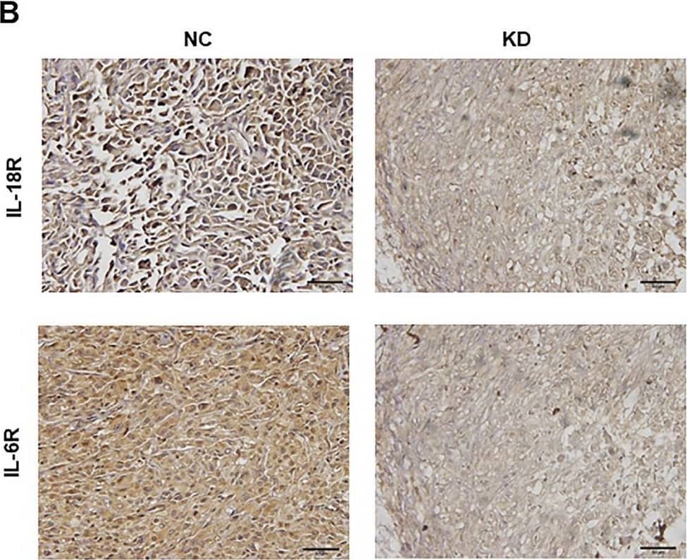 Immunohistochemistry IL-18R alpha/IL-1 R5 Antibody (70625) [Unconjugated]