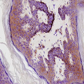 IL‑18 R alpha /IL‑1 R5 was detected in immersion fixed paraffin-embedded sections of Human Skin using Mouse Anti-Human IL‑18 R alpha /IL‑1 R5 Monoclonal Antibody (Catalog # MAB840) at 15 &micro;g/mL for 1 hour at room temperature followed by incubation with the Anti-Mouse IgG VisUCyte&trade; HRP Polymer Antibody (Catalog # VC001). Before incubation with the primary antibody, tissue was subjected to heat-induced epitope retrieval using VisUCyte Antigen Retrieval Reagent-Basic (VCTS021). Tissue was stained using DAB (brown) and counterstained with hematoxylin (blue). Specific staining was localized to cytoplasm and cell surface of keratinocytes. View our protocol for IHC Staining with VisUCyte HRP Polymer Detection Reagents.