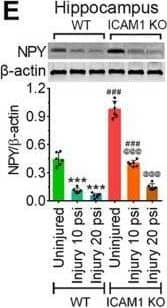 ICAM-1 reduces neurotransmitters expression that reflects in sensorimotor deficits and psychological stress after TBI. A, Immunofluorescent staining of NE (red) in the hippocampus area of WT and ICAM-1−/− mice after 10 and 20 psi FPI and merged with NeuN (green) and DAPI (blue). Scale bar: 20 μm (all panels). B, Quantification of NE staining in the hippocampus area of uninjured, 10 and 20 psi FPI WT and ICAM-1−/− mice using ImageJ software (n = 6/group). C–E, Western blot analysis of 5-HT1AR (C), DAD1R (D), NPY (E) and  beta -actin in the tissue lysates of hippocampus of WT and ICAM-1−/− mice 48 h after 10 and 20 psi FPI. The bar graph with dot plots shows the quantification of 5-HT1AR (C), DAD1R (D), NPY (E) versus  beta -actin (n = 6/group). F, Schematic presentation of the findings. All values are expressed as mean ± SD two-way ANOVA followed by Bonferroni post hoc tests. Statistically significant ***p < 0.001 versus WT uninjured group; @@@p < 0.001 versus uninjured ICAM-1−/− group; #p < 0.05, ##p < 0.01, ###p < 0.001 versus WT corresponding injury groups; ns = non-significant. NE, norepinephrine; 5-HT1AR, 5-HT 1A receptor; DAD1R, DA D1 receptor; NPY, neuropeptide Y. Image collected and cropped by CiteAb from the following open publication (//pubmed.ncbi.nlm.nih.gov/34135004), licensed under a CC-BY license. Not internally tested by R&D Systems.