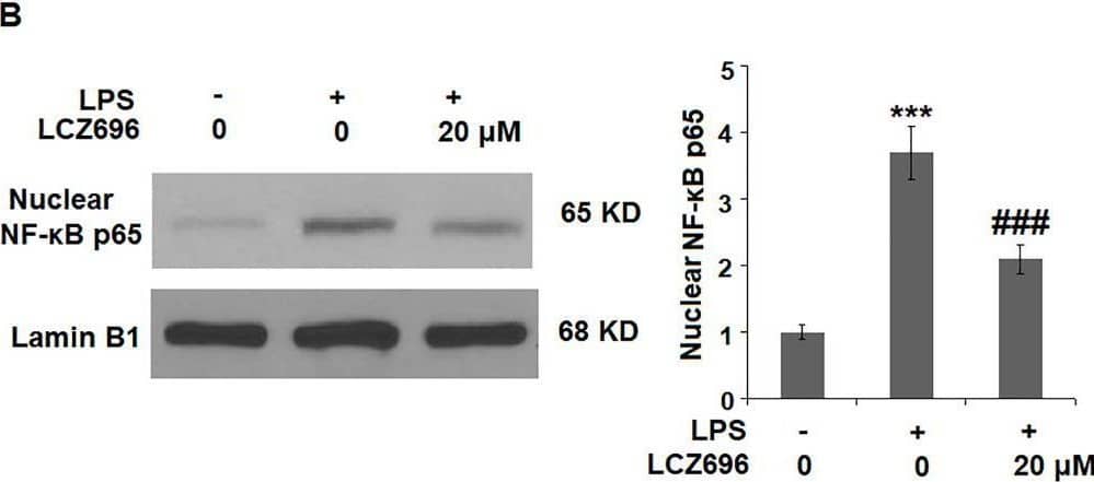 LCZ696 suppresses LPS-induced activation of the TLR4/Myd88 pathway in HUVECs.Cells were stimulated with LPS (1 μg/mL) in the presence or absence of LCZ696 (20 μM) for 24 hours. (A). The levels of TLR4 and Myd88 were measured using Western blot; (B). Nuclear levels of NF-kappa B p65 (***P < 0.005 vs. control group; ##, ###P < 0.01, 0.005 vs. LPS group). Image collected and cropped by CiteAb from the following open publication (//pubmed.ncbi.nlm.nih.gov/33839697), licensed under a CC-BY license. Not internally tested by R&D Systems.
