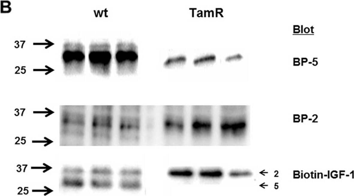 (A) Elisa determination of IGFBP-2 and -5 concentrations in conditioned medium (CM) from wt and TamR MCF-7 cell lines. Data represent mean ± SD (n = 3). Experiments were repeated on three separate occasions. *p < 0.001, **p < 0.0001 (Student's unpaired t-test). (B) Western blot (upper two panels) and Ligand blot (lower panel) identifies IGFBP-2 (upper arrow Ligand blot) and IGFBP-5 (lower panel Ligand blot) in CM from wt and TamR MCF-7 cells. (C) Densitometric analysis of Western blots for IGFBP-2 (upper graph) and IGFBP-5 (lower graph) band intensity. Triplicate lanes per blot were analysed for both wt and TamR conditioned media using Image Lab software. Data are presented as mean +/− SD (n = 3) of Arbitrary Unit (AU) intensity. This experiment was repeated 3 times with similar results in each instance. *p < 0.005 TamR v MCF-7 Students t-test. GraphPad Prism 5.0. Image collected and cropped by CiteAb from the following publication (//pubmed.ncbi.nlm.nih.gov/27050076), licensed under a CC-BY license. Not internally tested by R&D Systems.