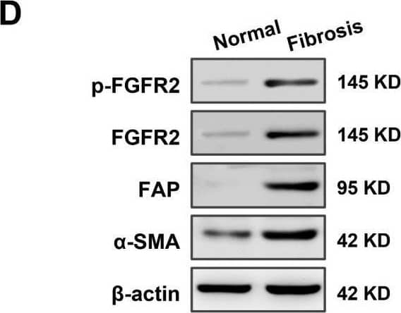 Western Blot beta-Actin Antibody (937215) [Unconjugated]