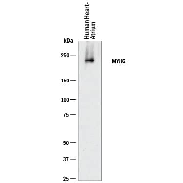 Western Blot MYH6 Antibody (940344) [Unconjugated]