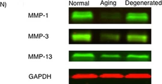 MMP-1, MMP-3, and MMP-13 expression. (A-D) MMP-1; (E-H) MMP-3; (I-L) MMP-13 (A,E,I) ACL from young normal knee; (B,F,J) ACL from aging knee; (C,G,K) fibroblast-like cell aggregates in the degenerated ACL; (D,H,L) chondrocyte-like cell aggregates in the degenerated ACL. (Original magnification ×40). The graph (M) represents the percentage (mean ± SEM) of MMP-1-, MMP-3-, and MMP-13-positive cells in each group. **P < 0.01. (N) Western blotting for MMP-1, MMP-3, and MMP-13 (n = 3 for each category). Image collected and cropped by CiteAb from the following open publication (//arthritis-research.biomedcentral.com/articles/10.1186/ar4165), licensed under a CC-BY license. Not internally tested by R&D Systems.