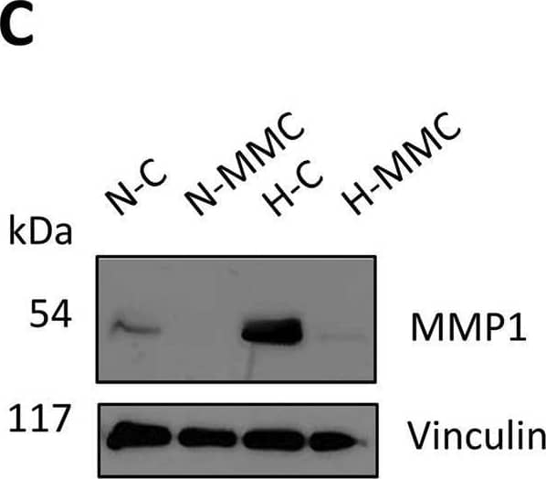 Expression of MMP1 on gene and protein levels upon treatment with mitomycin C (MMC) of SKOV3 cells in normoxia and hypoxia. MMP1 gene expression was measured using (A) HTA 2.0 microarrays and (B) RT-qPCR [normalized to PPIA and GUSB levels and normoxia control (NC) as 1]. (C) Immunoblot of MMP 1 protein (with vinculin as loading control). (D) Quantification of MMP1 protein levels by densitometry. (E) Secretion of pro-MMP1 protein levels measured by ELISA.(F) Secretion of total MMP1 protein levels measured by ELISA. (B,D) Results were normalized to normoxia control as 1. ****p < 0.0001, ***p < 0.001, **p < 0.01, and *p < 0.05; VIN, vinculin. A detailed statistics description is provided in the Supplementary Table S2. Image collected and cropped by CiteAb from the following open publication (//pubmed.ncbi.nlm.nih.gov/40584967), licensed under a CC-BY license. Not internally tested by R&D Systems.