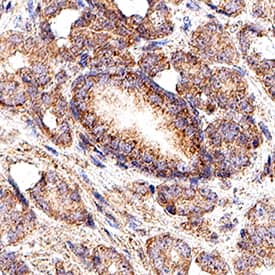 Immunohistochemistry MMP-14/MT1-MMP Antibody (128527) [Unconjugated]