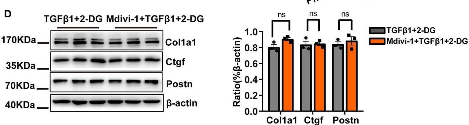 Reducing the cardiac fibroblasts (CF) glycolytic flux may be important for mitochondrial fission inhibition-induced suppression of CF activation. (A) Measurements of the extracellular acidification rate (ECAR) metabolic profile by Seahorse XF glycolytic rate assay kit and analyses of CF Proton Efflux Rate (PER) in basal glycolysis and glycolysis capacity. (B) The oxygen consumption rate (OCR) as measured using a Seahorse XF Cell Mito Stress Test Kit and analyses of the OCR under basal and maximum respiration. (C) Western blot analyses and quantification of key glycolytic enzymes under TGF-beta 1 plus mdivi-1 cotreatment. (D) The expression of CF activation-related markers was measured by immunoblotting following TGF-beta 1 plus mdivi-1 cotreatment and in the presence or absence of 2-DG. Data are shown as mean ± standard error of the mean (n = 3 independent cell isolations per group). Means were compared by one-way ANOVA, followed by the Student–Newman–Keuls (SNK) post hoc test. ns, not significant; *P < 0.05; **P < 0.01; ***P < 0.001. Image collected and cropped by CiteAb from the following open publication (//pubmed.ncbi.nlm.nih.gov/33585469), licensed under a CC-BY license. Not internally tested by R&D Systems.