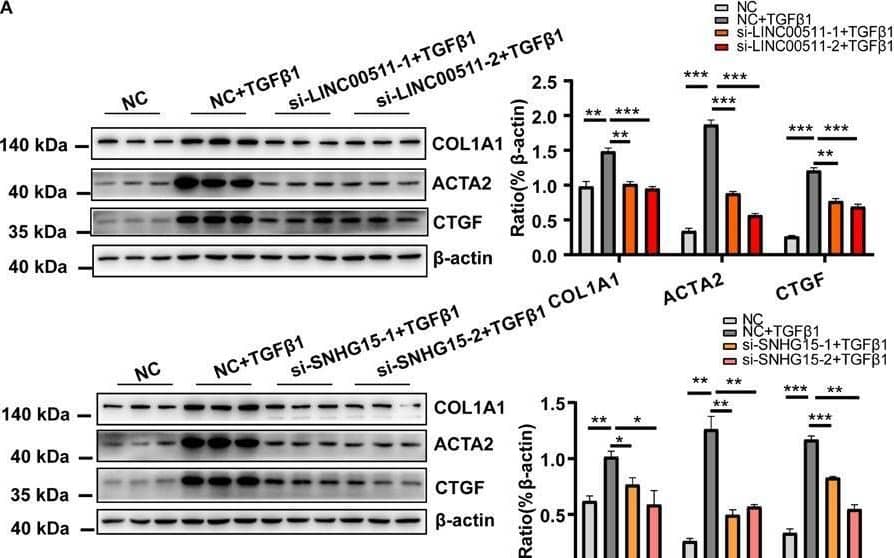 Functional validation of LINC00511 and SNHG15 in activation of cardiac fibroblasts. (A) Knockdown of expression of LINC00511 and SNHG15 reduced expression of myofibroblast-associated genes. (B) Depletion of LINC00511 and SNHG15 can reduce collagen secretion in HCF-cultured supernatants. (C) Depletion of LINC00511 and SNHG15 can reduce myofibroblast proliferation in 1 and 2 days, respectively. n = 3 per group. *P < 0.05, **P < 0.01, ***P < 0.001. Image collected and cropped by CiteAb from the following open publication (//pubmed.ncbi.nlm.nih.gov/33552116), licensed under a CC-BY license. Not internally tested by R&D Systems.