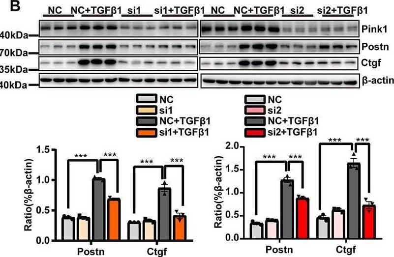 The suppression of mitophagy inhibited cardiac fibroblasts (CF) activation. CF were transfected with either Pink1 siRNA or negative control (NC) and then stimulated with TGF-beta 1. (A)  alpha -SMA immunofluorescence staining and semi-quantitative analysis. (B) Immunoblot analyses and quantitative analyses of the markers of CF activation, Postn and Ctgf, among the different groups. EdU and vimentin staining (C) and the MTS cell proliferation assay (D) were used to evaluate CF proliferation. (E) A wound healing assay was performed to evaluate CF migratory capacity following the different treatments. (F) Measurement of lysyl oxidase (LOX) activity. (G) The relative expression levels of extracellular matrix (ECM)-related proteins normalized to that of beta-actin. (H) Cell apoptosis was compared among the different groups by flow cytometry. Data are shown as mean ± standard error of the mean (n = 3 independent cell isolations per group). Means were compared by one-way ANOVA, followed by the Student–Newman–Keuls (SNK) post hoc test. *P < 0.05; **P < 0.01; ***P < 0.001. Image collected and cropped by CiteAb from the following open publication (//pubmed.ncbi.nlm.nih.gov/33585469), licensed under a CC-BY license. Not internally tested by R&D Systems.