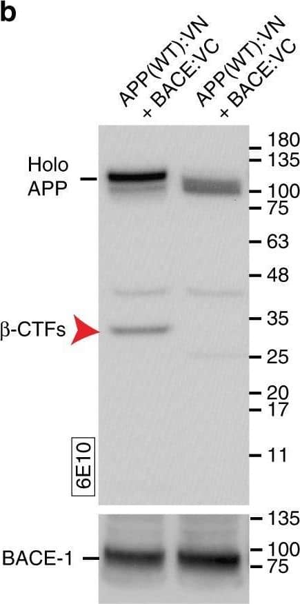 Western Blot BACE-1 Antibody (137612)