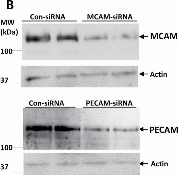 MCAM and PECAM are both involved in PNA-mediated cytokine secretion. The presence of ASF or neutralizing antibodies to MCAM or PECAM reduced PNA-mediated secretion of MCP-1 and IL-6 (A) from HUVECs. siRNA suppression of MCAM and PECAM expression (B) each abolished PNA-induced secretion of MCP-1 and IL-6 (C). Data are presented as Mean ± SD of three independent experiments, each in triplicate. **p < 0.01, ***p < 0.001. Image collected and cropped by CiteAb from the following open publication (//pubmed.ncbi.nlm.nih.gov/34223877), licensed under a CC-BY license. Not internally tested by R&D Systems.
