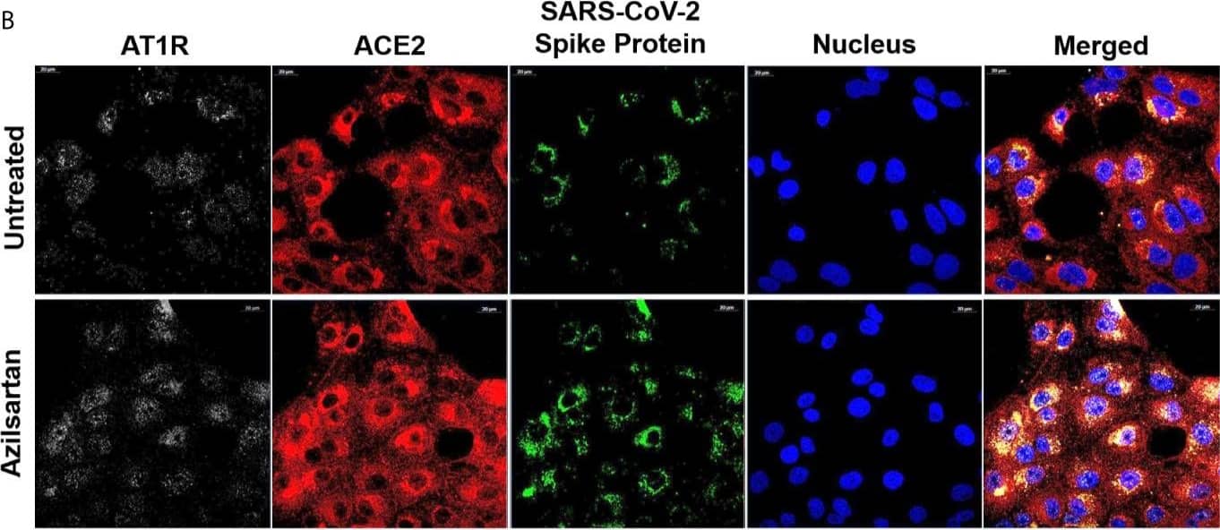 Modulation of cell surface-expressed ATR1 and ACE2 molecules in Vero E6 cells infected with SARS-CoV-2 (24 h.p.i) and treated with Azilsartan (15 µM) for 72 hours by immunofluorescence microscopy. (A) Schematic flow of the analysis: Vero E6 cells were treated with various ARBs (the MTT assay previously defined non-cytotoxic concentrations: Azilosartan 15µM; Eprosartan 30µM; Irbesartan 60µM; Losartan 7µM; Olmesartan 15µM; Telmisartan 7µM; Valsartan 7µM) for 72 hours and were subsequently infected for analysis of ACE2 and ATR1 on treated and infected cells, 24 hours post-infection (h.p.i.). (B) The panel presents SARS-CoV-2 infected cells after incubation with Azilsartan (15 µM) and evaluation of fluorescence corresponding to the ATR1, ACE2, viral spike protein, and the nucleus of the cells. The merge of the images is displayed at the right of the panel. Images were acquired using a confocal microscope (Zeiss LSM 800) with a 63X/1.4 oil objective. (C) Quantitative representation of Mean Fluorescence corresponding to ATR1 and ACE2 molecules expression on VERO E6 cells treated or not treated with Azilsartan and SARS-CoV-2 in the cells. ***P < 0.001; ****P < 0.0001. Image collected and cropped by CiteAb from the following open publication (//pubmed.ncbi.nlm.nih.gov/34178717), licensed under a CC-BY license. Not internally tested by R&D Systems.