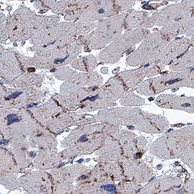 Irisin/FNDC5 was detected in immersion fixed paraffin-embedded sections of Human Heart using Mouse Anti-Human Irisin/FNDC5 Monoclonal Antibody (Catalog # MAB94202) at 5 µg/mL for 1 hour at room temperature followed by incubation with the Anti-Mouse IgG VisUCyte™ HRP Polymer Antibody (Catalog # VC001). Before incubation with the primary antibody, tissue was subjected to heat-induced epitope retrieval using VisUCyte Antigen Retrieval Reagent-Basic (Catalog # VCTS021). Tissue was stained using DAB (brown) and counterstained with hematoxylin (blue). Specific staining was localized to intercalated disks. View our protocol for IHC Staining with VisUCyte HRP Polymer Detection Reagents.