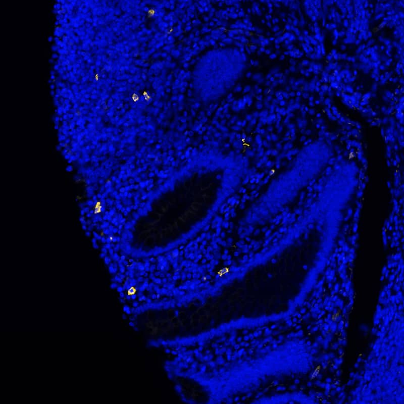 IgM was detected in immersion fixed paraffin-embedded sections of human appendix using Rabbit Anti-Human IgM, Monoclonal Antibody (Catalog #MAB9435) at 0.2ug/mL at 37° Celsius for 4 minutes. Before incubation with the primary antibody, tissue underwent an all-in-one dewaxing and antigen retrieval preprocessing using PreTreatment Module (PT Module) and Dewax and HIER Buffer H (pH 9; Epredia Catalog #TA-999-DHBH). Tissue was stained using the Alexa Fluor™ Plus 555 Goat anti-Rabbit IgG Secondary Antibody at 1:100 at 37 ° Celsius for 2 minutes. (Yellow; Lunaphore Catalog # DR555RB) and counterstained with DAPI (blue; Lunaphore Catalog # DR100). Specific staining was localized to the membrane. Protocol available in COMET™ Panel Builder.​