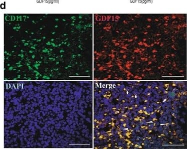 The relationship of GDF15 expression and small marrow adipocytes in AML patients. a RT-qPCR analysis of GDF15 mRNA expression in BM from AML patients (n = 15) and the controls (n = 12). The results shown are from three independent experiments. *P < 0.05. b Western blotting analysis of GDF15 protein levels in BM from AML patients and the controls. The densitometry values of protein expression changes were indicated.  beta -actin protein was used as an internal control for Western blotting analysis. c and d Representative confocal images showed the expression of GDF15 and leukemic cell markers CD34 (c) or CD117 (d) in BM sections of AML patients. DAPI was used to stain the nuclei. White triangles showed the leukemic cells with GDF15+. White arrows showed the non-leukemic cells with GDF15. Scale bar represents 40 μm. e and f Scatter plot showed the positive correlation of small adipocyte volume (e) or small adipocyte number (f) with the level of GDF15 in BM of AML (n = 20, R = 0.6679, P = 0.0013, or n = 20, R = 0.7205, P = 0.003, Spearman correlation test) Image collected and cropped by CiteAb from the following open publication (//pubmed.ncbi.nlm.nih.gov/29566722), licensed under a CC-BY license. Not internally tested by R&D Systems.