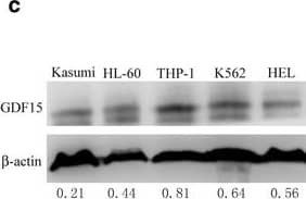 AML cell lines highly express GDF15. a RT-qPCR analysis of different cytokines associated with the regulation of adipogenesis in AML cell lines (K562, THP-1 and HL-60). GAPDH was used as a housekeeping gene. *P < 0.05, ***P < 0.001. b and c, RT-qPCR (b) and Western blotting (c) analysis of GDF15 in different cell lines (Kasumi, HL-60, THP-1, K562 and HEL). The densitometry values of protein expression changes were indicated.  beta -actin was used as an internal control for RT-qPCR and Western blotting analysis. d ELISA detection of GDF15 expression in the supernatant of THP-1 cells with different cell densities Image collected and cropped by CiteAb from the following open publication (//pubmed.ncbi.nlm.nih.gov/29566722), licensed under a CC-BY license. Not internally tested by R&D Systems.