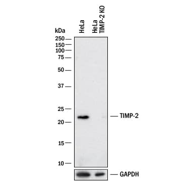<b>Genetic Strategies Validation. </b>Western blot shows lysates of HeLa human cervical epithelial carcinoma cell line and human TIMP-2 knockout HeLa human cervical epithelial carcinoma cell line (KO). PVDF membrane was probed with 2 µg/mL of Goat Anti-Human TIMP‑2 Monoclonal Antibody (Catalog # MAB97112) followed by HRP-conjugated Anti-Goat IgG Secondary Antibody (HAF017). A specific band was detected for TIMP‑2 at approximately 22 kDa (as indicated) in the parental HeLa human cervical epithelial carcinoma cell line, but is not detectable in knockout HeLa human cervical epithelial carcinoma cell line. GAPDH (MAB5718) is shown as a loading control. This experiment was conducted under reducing conditions and using Western Blot Buffer Group 1.
