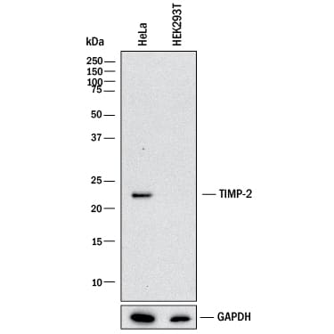Western blot shows lysates of HeLa human cervical epithelial carcinoma cell line and HEK293T human embryonic kidney cell line (negative control). PVDF membrane was probed with 1 µg/mL of Goat Anti-Human TIMP‑2 Monoclonal Antibody (Catalog # MAB97112) followed by HRP-conjugated Anti-Goat IgG Secondary Antibody (HAF017). A specific band was detected for TIMP‑2 at approximately 22 kDa (as indicated). GAPDH (Catalog # MAB5718) is shown as a loading control. This experiment was conducted under reducing conditions and using Western Blot Buffer Group 1.