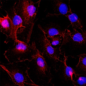 EMMPRIN/CD147 was detected in immersion fixed 789-O Human renal cell carcinoma cell line using Mouse Anti-Human EMMPRIN/CD147 Monoclonal Antibody (Catalog # MAB9721) at 8 &micro;g/mL for 3 hours at room temperature. Cells were stained using the NorthernLights&trade; 557-conjugated Anti-Mouse IgG Secondary Antibody (red; NL007) and counterstained with DAPI (blue). Specific staining was localized to cell membrane. Staining was performed using our protocol for Fluorescent ICC Staining of Non-adherent Cells.