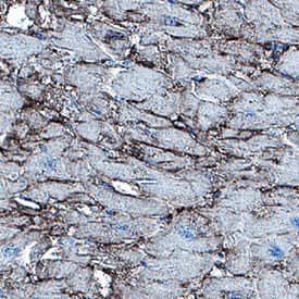 EMMPRIN/CD147 was detected in immersion fixed paraffin-embedded sections of human heart using Mouse Anti-Human EMMPRIN/CD147 Monoclonal Antibody (Catalog # MAB9721) at 5 &micro;g/mL for 1 hour at room temperature followed by incubation with the Anti-Mouse IgG VisUCyte&trade; HRP Polymer Antibody (VC001). Before incubation with the primary antibody, tissue was subjected to heat-induced epitope retrieval using Antigen Retrieval Reagent-Basic (CTS013). Tissue was stained using DAB (brown) and counterstained with hematoxylin (blue). Specific staining was localized to cell membrane in capillaries. Staining was performed using our protocol for IHC Staining with VisUCyte HRP Polymer Detection Reagents.