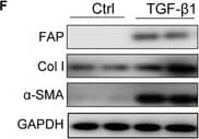 FAP expression is up-regulated in the myocardium of isoproterenol (ISO) mice and in cardiac fibroblasts upon TGF-beta 1 stimulation. (A) Quantitative polymerase chain reaction (qPCR) analysis showing messenger RNA (mRNA) expression levels of Col1 alpha 1, Acta2, and FAP in heart tissue from ISO-treated mice. n = 6. Data are presented as mean ± SEM. **P < 0.01; ****P < 0.0001. (B) Western blotting analysis of Col1 alpha 1,  alpha -smooth muscle actin ( alpha -SMA), and FAP protein expressions in the hearts of mice treated with ISO or saline. (C) Sirius Red staining and immunohistochemical staining for FAP in hearts from ISO-treated mice. (D) mRNA expression levels of Col1 alpha 1, Acta2, and FAP in neonatal rat cardiac fibroblasts (NRCFs) treated with TGF-beta 1 (10 ng/ml) for 24 h, assessed by qPCR. (E) Western blotting analysis of FAP protein expression in NRCFs after TGF-beta 1 treatment. (F) Flow cytometry analysis of FAP protein expression in NRCFs following TGF-beta 1 treatment. (G) Immunofluorescence (IF) analysis of FAP protein expression in NRCFs post-TGF-beta 1 treatment. IHC, immunohistochemical; Col I, type I collagen; PBS, phosphate-buffered saline; Ctrl, control; GAPDH, glyceraldehyde-3-phosphate; DAPI, 4′,6-diamidino-2-phenylindole. Image collected and cropped by CiteAb from the following open publication (//pubmed.ncbi.nlm.nih.gov/40225952), licensed under a CC-BY license. Not internally tested by R&D Systems.