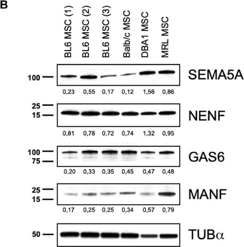 MRL MSC produced and released higher amount of MANF than BL6, BALB/c and DBA1 MSC. (A) Proteomic analysis of differential expression of MANF, GAS6, NENF, and SEMA5A in MRL MSC compared to BL6 MSC secretomes. Effect size indicate the standardized mean difference in protein expression level between MRL MSC and BL6 MSC. For each protein, the median intensity levels (Log 2 value) in MRL MSC and BL6 MSC are indicated. Normalized protein intensities were used to calculate the Effect size MRL/BL6. (B) Western blot analysis of MANF, GAS6, NENF, and SEMA5A in whole-cell extracts from BL6, BALB/c and DBA1 MSC. The intensity value of each target protein band was normalized against the intensity value of  alpha -Tubulin gel band used as the internal loading control for each sample. (C)MANF mRNA expression level in MRL MSC and BL6 MSC. Western blot analysis of supernatants of BL6, BALB/c, and DBA1 MSC showing blotted proteins stained with Ponceau S (D) and the MANF protein band revealed by the anti-MANF antibody (E). MRL MSC whole cell extract was used as a positive control. Image collected and cropped by CiteAb from the following open publication (//pubmed.ncbi.nlm.nih.gov/33738280), licensed under a CC-BY license. Not internally tested by R&D Systems.