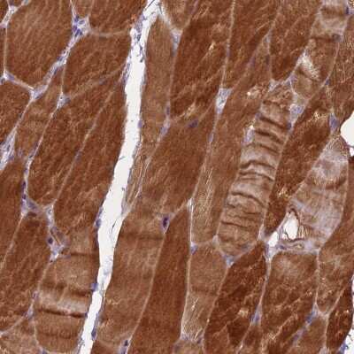 Immunohistochemistry-Paraffin: mediator of cell motility 1 Antibody [NBP1-88269] - Staining of human skeletal muscle shows strong cytoplasmic positivity in myocytes.
