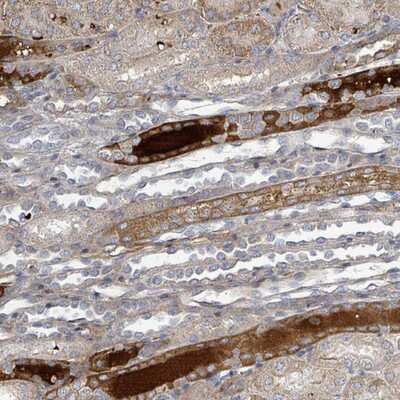 Immunohistochemistry-Paraffin: metabotropic Glutamate Receptor 8 Antibody [NBP2-14073] Staining of human kidney shows distinct cytoplasmic and extracellular positivity.