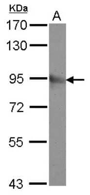 Western Blot: mGluR8 Antibody [NBP2-17278] -  Sample (30 ug of whole cell lysate) A: A549 7. 5% SDS PAGE gel, diluted at 1:500.