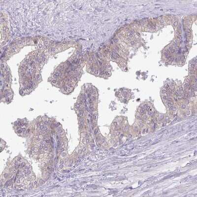 Immunohistochemistry-Paraffin: methyltransferase like 9 Antibody [NBP2-31564] - Staining of human prostate shows weak membranous positivity in glandular cells.