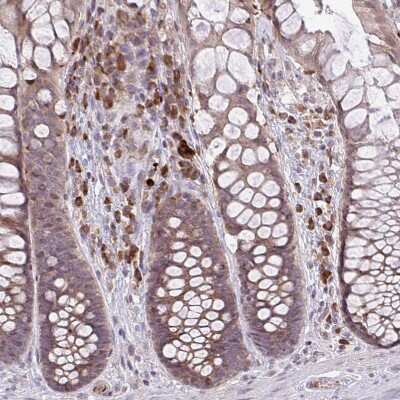 Immunohistochemistry-Paraffin: methyltransferase like 9 Antibody [NBP2-31564] - Staining of human rectum shows moderate cytoplasmic positivity in lymphoid cells.