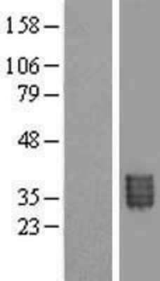 Western Blot: methyltransferase like 9 Overexpression Lysate (Adult Normal) [NBL1-13030] Left-Empty vector transfected control cell lysate (HEK293 cell lysate); Right -Over-expression Lysate for methyltransferase like 9.