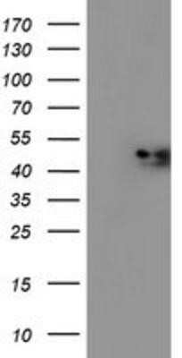 Western Blot: midA Antibody (OTI4A5) - Azide and BSA Free [NBP2-72681] - HEK293T cells were transfected with the pCMV6-ENTRY control (Left lane) or pCMV6-ENTRY midA (Right lane) cDNA for 48 hrs and lysed. Equivalent amounts of cell lysates (5 ug per lane) were separated by SDS-PAGE and immunoblotted with anti-midA.