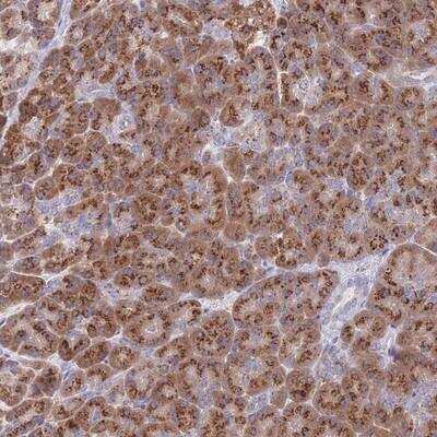 Immunohistochemistry-Paraffin mitochondrial ribosomal protein L30 Antibody - BSA Free
