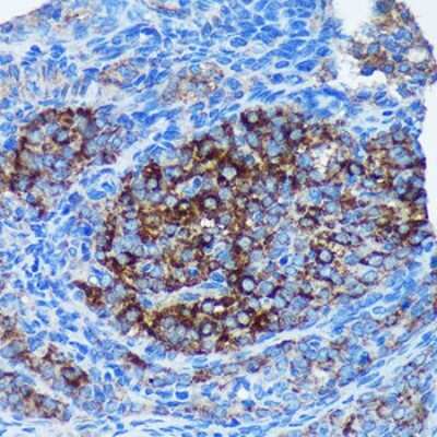 Immunohistochemistry-Paraffin: mitochondrial ribosomal protein L30 Antibody [NBP3-03295] - Immunohistochemistry of paraffin-embedded Rat ovary using mitochondrial ribosomal protein L30 Rabbit pAb (NBP3-03295) at dilution of 1:100 (40x lens).