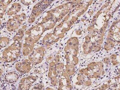 Immunohistochemistry-Paraffin: mitochondrial ribosomal protein L30 Antibody [NBP3-05921] - Staining of human MRPL30 in human stomach with rabbit polyclonal antibody at 1:100 dilution.