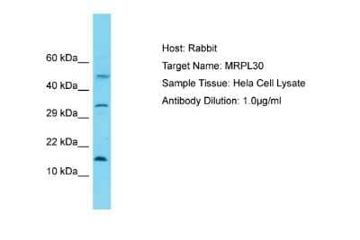 Western Blot: mitochondrial ribosomal protein L30 Antibody [NBP2-83209] - Host: Rabbit. Target Name: MRPL30. Sample Tissue: Human Hela Whole Cell. Antibody Dilution: 1ug/ml