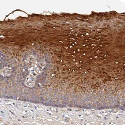 Immunohistochemistry-Paraffin mitochondrial ribosomal protein L35 Antibody - BSA Free