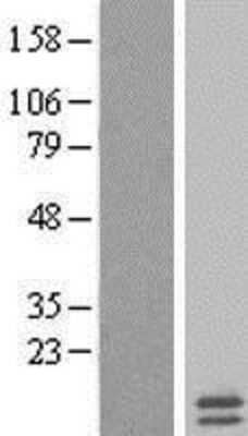 Western Blot: mitochondrial ribosomal protein L35 Overexpression Lysate (Adult Normal) [NBL1-13260] Left-Empty vector transfected control cell lysate (HEK293 cell lysate); Right -Over-expression Lysate for mitochondrial ribosomal protein L35.