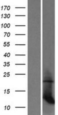 Western Blot: mitochondrial ribosomal protein L35 Overexpression Lysate (Adult Normal) [NBP2-07009] Left-Empty vector transfected control cell lysate (HEK293 cell lysate); Right -Over-expression Lysate for mitochondrial ribosomal protein L35.