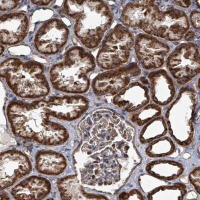 Immunohistochemistry-Paraffin mitochondrial ribosomal protein L4 Antibody