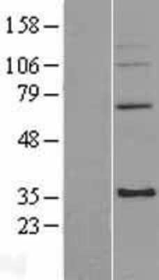 Western Blot: mitochondrial ribosomal protein L4 Overexpression Lysate (Adult Normal) [NBL1-13265] Left-Empty vector transfected control cell lysate (HEK293 cell lysate); Right -Over-expression Lysate for mitochondrial ribosomal protein L4.