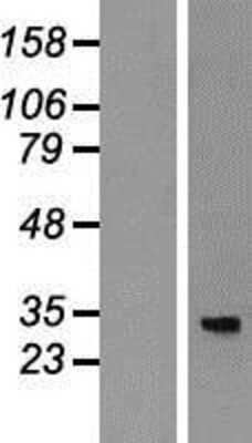 Western Blot: mitochondrial ribosomal protein L4 Overexpression Lysate (Adult Normal) [NBP2-07111] Left-Empty vector transfected control cell lysate (HEK293 cell lysate); Right -Over-expression Lysate for mitochondrial ribosomal protein L4.