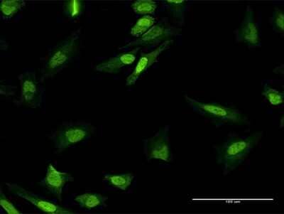 Immunocytochemistry/Immunofluorescence: mpp8 Antibody [H00054737-B01P] - Analysis of purified antibody to MPHOSPH8 on HeLa cell. (antibody concentration 10 ug/ml)