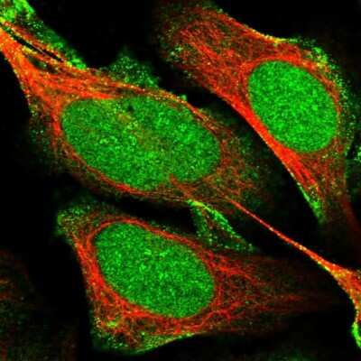 Immunocytochemistry/Immunofluorescence: mpp8 Antibody [NBP1-92135] - Staining of human cell line U-2 OS shows localization to nucleus, nucleoli and plasma membrane.